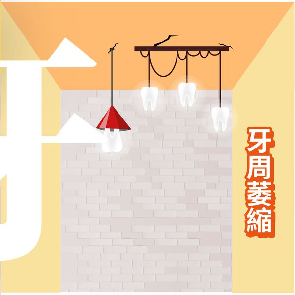牙周治療