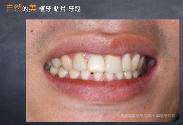 美觀重建案例