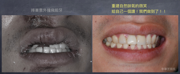 美觀重建案例